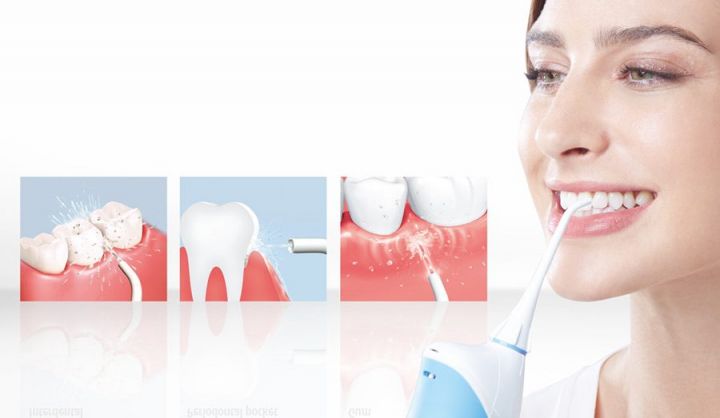 Curata dintii cu un irigator bucal: avantaje, tipuri, preturi si recomandari